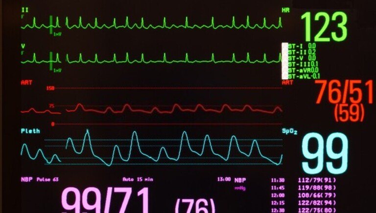 How Do You Train With Heart Rate Variability? How Do You Train With Heart Rate Variability?